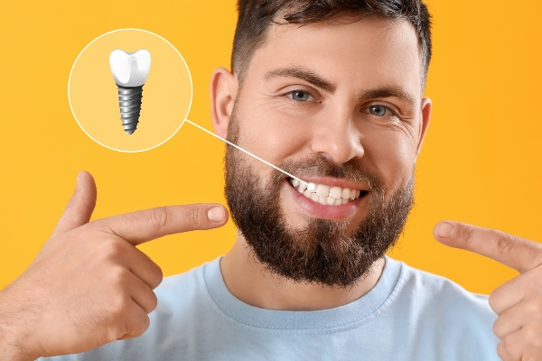 Dental Implants To Replace Missing Teeth